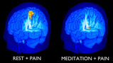 档案名称 : Benefits-of-meditation-2-pain.jpg
档案大小 : 76KB
影像尺寸 : 550x308
加入日期 : 六月 08, 2015 Benefits-of-meditation-2-pain.jpg