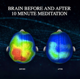 档案名称 : yoga_by_you_your_brain_on_meditation-WSD-04182014.png
档案大小 : 97KB
影像尺寸 : 639x632
加入日期 : 六月 08, 2015 yoga_by_you_your_brain_on_meditation-WSD-04182014.png